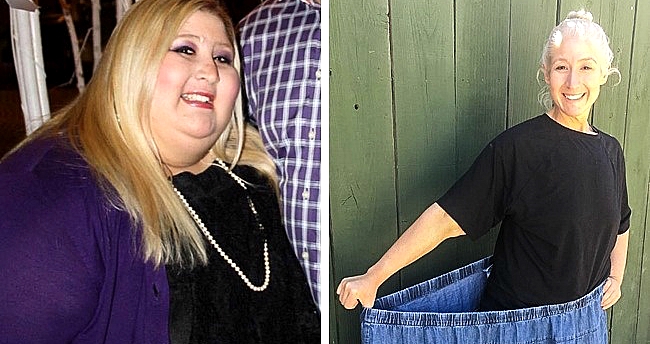 Она похудела на 135 кг, а в результате столкнулась с еще одной ужасной проблемой