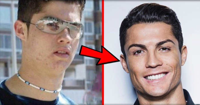 Известный футболист Криштиану Роналду: до и после пластики