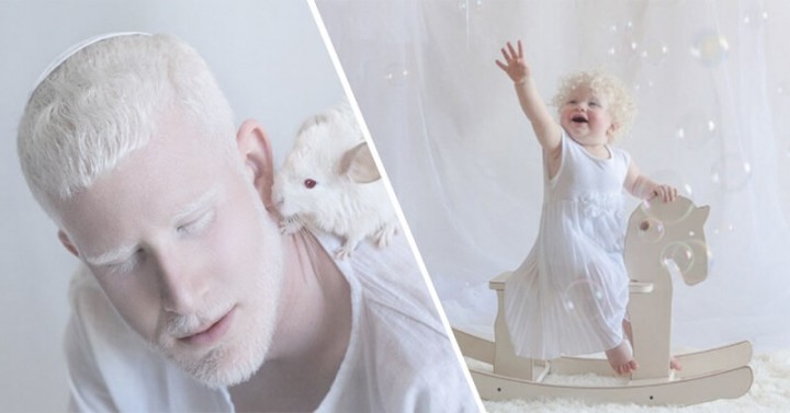 35 людей-альбиносов, гипнотизирующих своей магической красотой