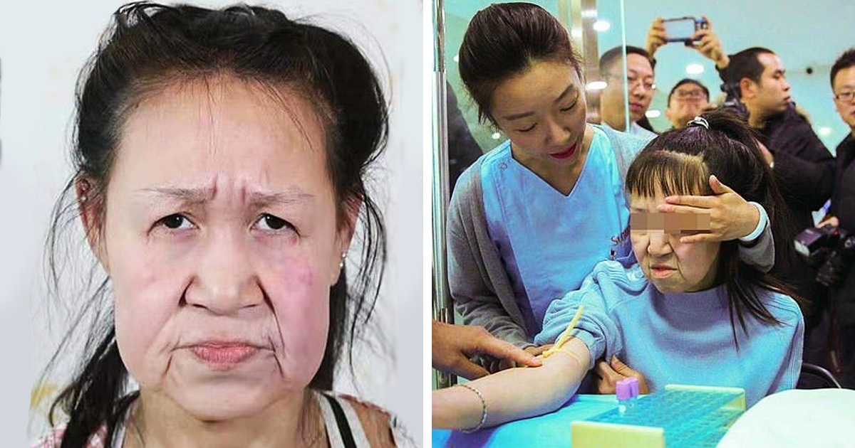 15-летняя школьница сделала операцию, что бы не выглядеть как старушка