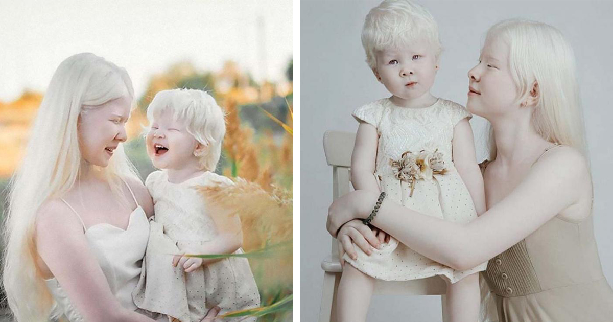 Сёстры-альбиносы удивили всех – а родились они с разницей в 12 лет