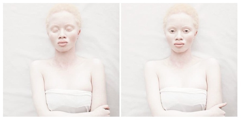 Удивительные студийные снимки людей-альбиносов